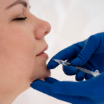 Facial Fat Grafting in Houston