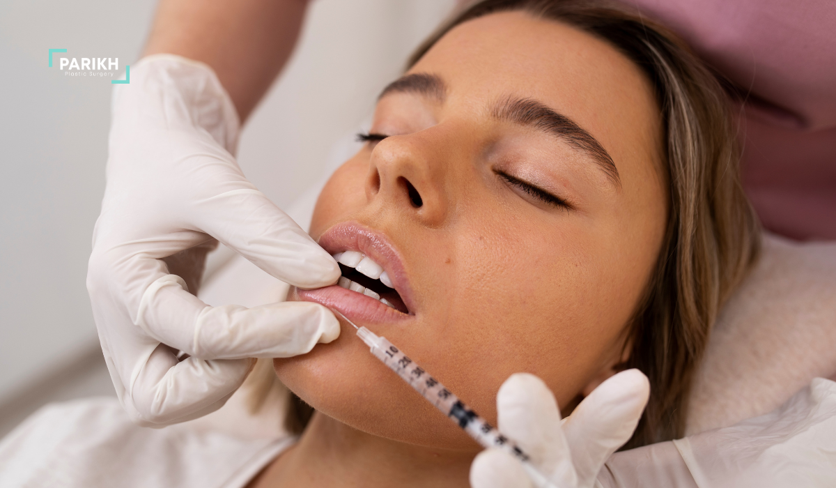 lip lift vs. lip fillers