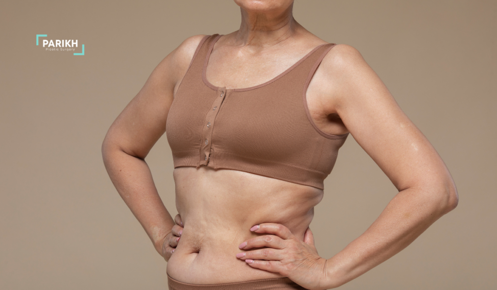 Recovery Time for a Tummy Tuck? | Houston Plastic Surgery