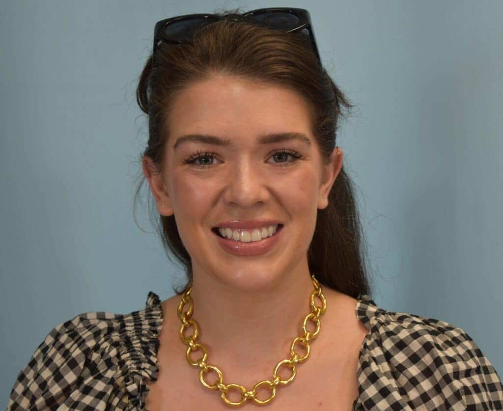 Before Image: Submental Liposuction - front