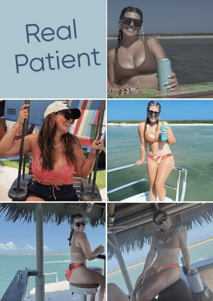 Mommy Makeover Patient Houston Texas