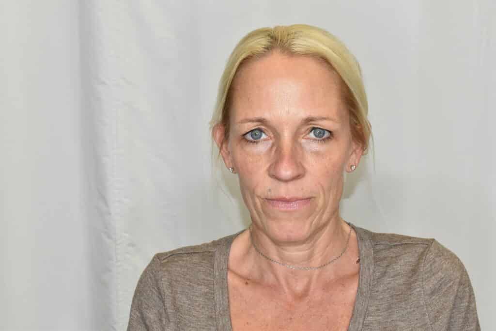 Before Image: Facelift - front